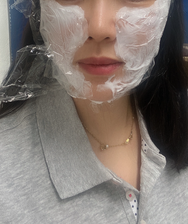  베이비보톡스 후기