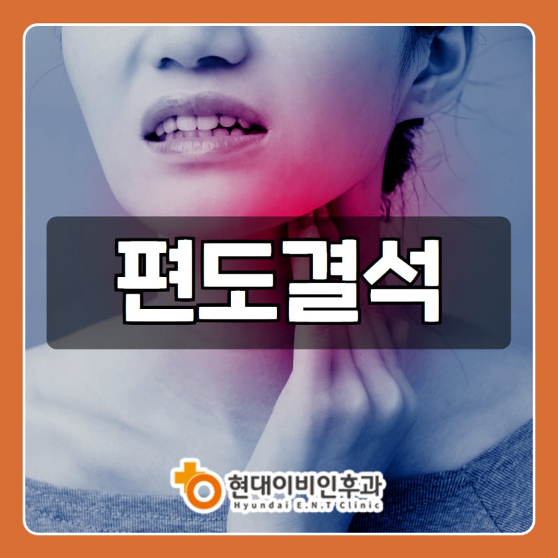 편도결석이 생기는 원인부터 제거 방법 [대전선화동이비인후과]