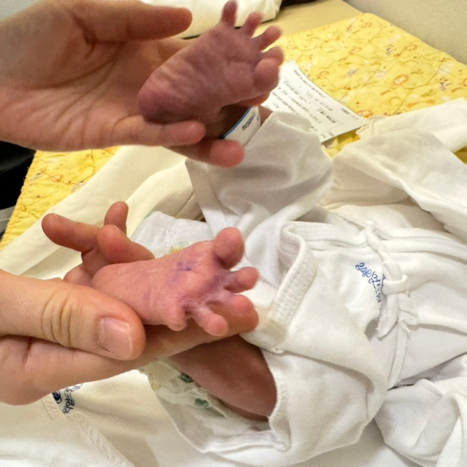  제왕절개 수술기록 2일차-5일차