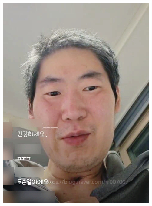  19기 영철 병명 투병 생활 수술 충격적인 근황 1년 사이 무슨일이? 나는솔로