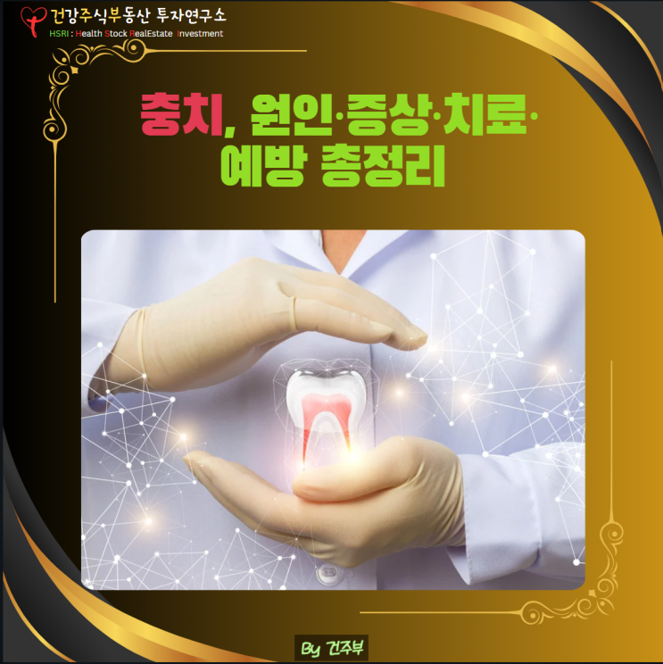  충치, 방치하면 큰일 납니다! 원인·증상·치료·예방 총정리