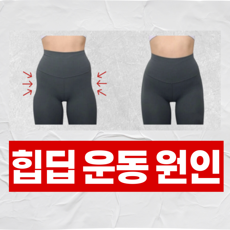  힙딥 운동 원인 해결책까지 알려드립니다