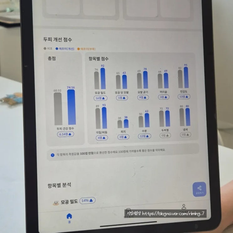  양산 에스테틱 디에이치뷰티 에어바디&SMP 두피관리 후기