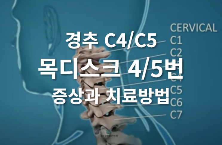  정자동 목디스크 한의원 #목디스크 4번,5번 증상과 비수술 한방 치료 분당 한방 재활의학과