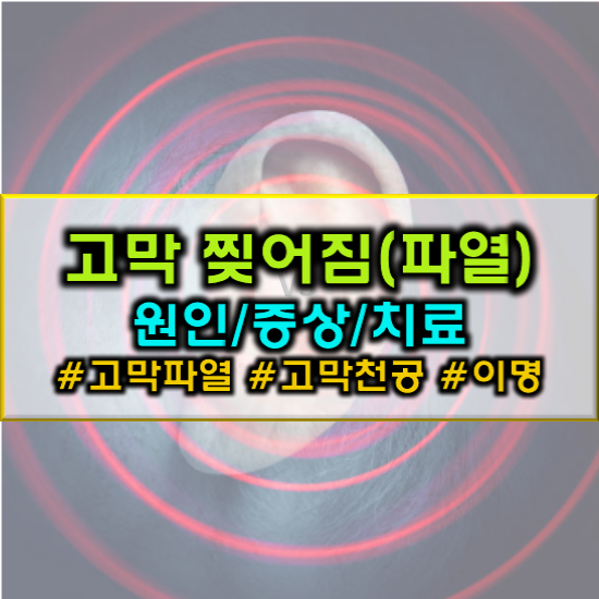 고막 찢어지면 증상, 원인 치료 교정은?