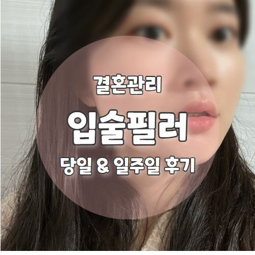  웨딩촬영 전 옹졸한 입술 탈출한 예신 리얼 입술필러 일주일후기