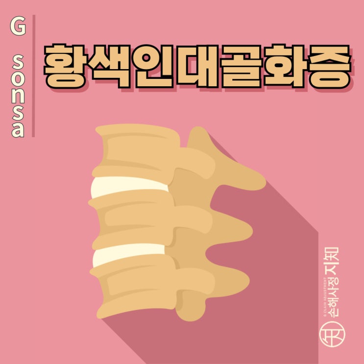  황색인대골화증 - 척추 신경을 압박하는 황색인대의 변화 - [척추질환, AlDa]