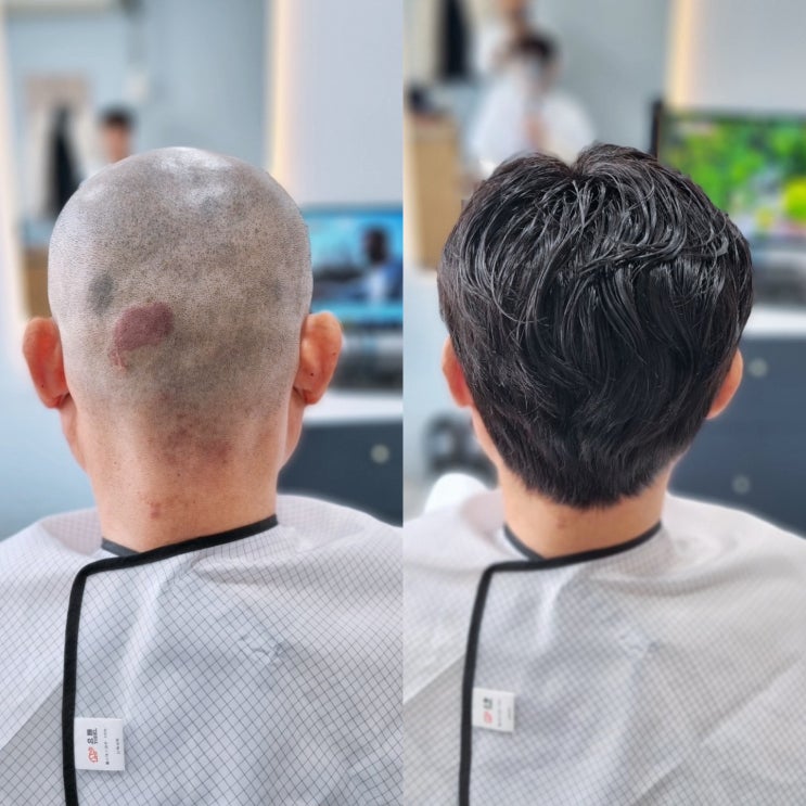  부산부분가발 젊음을쓰다 자연스럽고 편안하게
