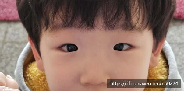 [소아 내사시 의심]부평한길안과병원/소아안과_32개월 아기 내사시 검사,시력검사