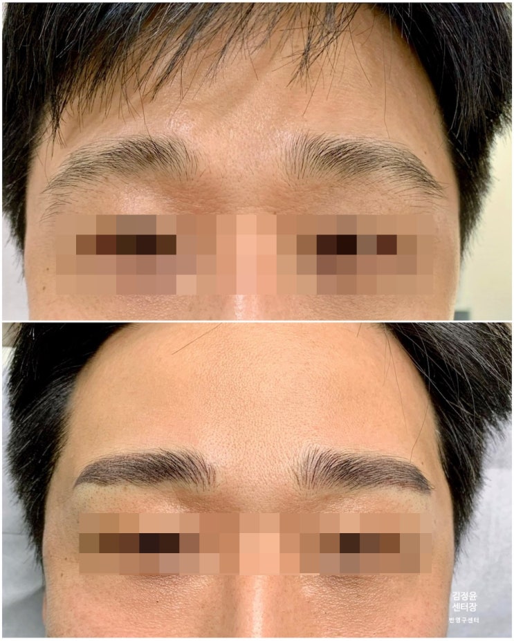  비대칭 남자 눈썹 반영구 문신 자연스러운 균형 결과