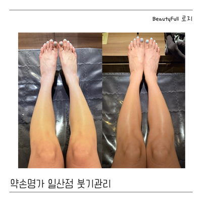  맞춤관리 C 다리 붓기 케어 약손명가일산점 후기