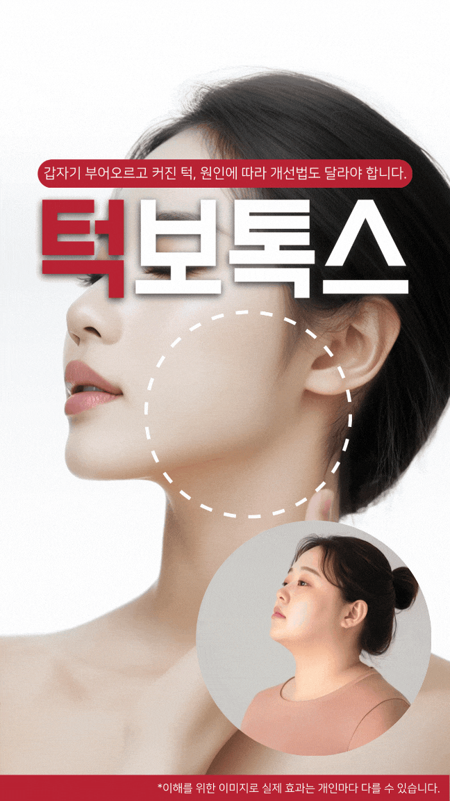 광주사각턱보톡스 침샘으로 인한 이중턱까지 개선하려면