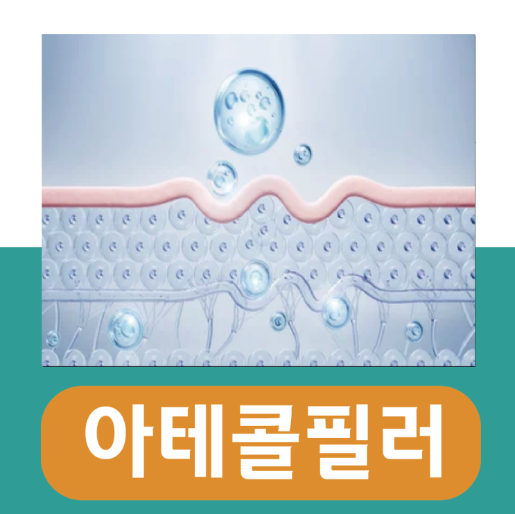  반영구 필러 아테콜 효과 및 부작용은?