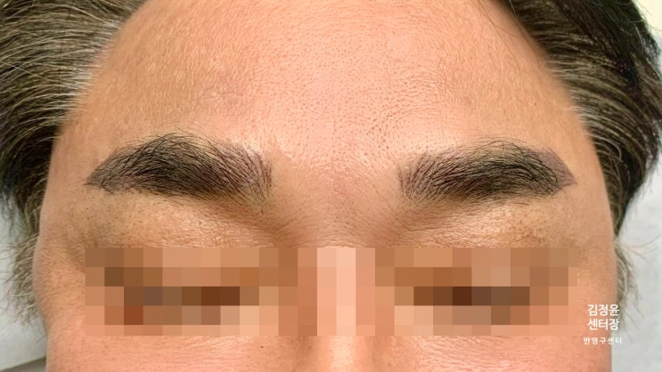  분당 남자 반쪽 눈썹 교정 반영구 문신
