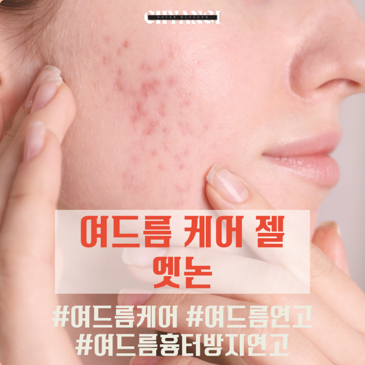  일본 여드름 흉터 케어 연고 [엣논] 젤타입 주근깨 방지 크림 가격 후기 효과