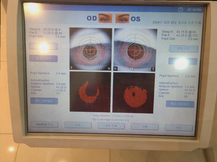  대구태전동안경, 편안한 눈을 위한 K비젼안경 태전점