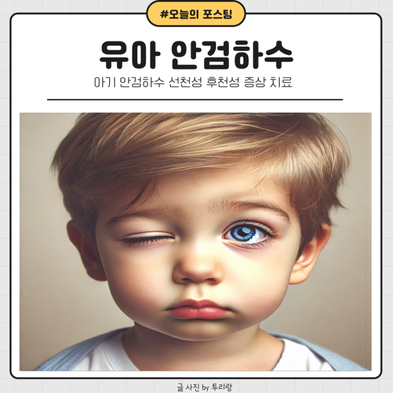 아기 안검하수 선천성 후천성 증상 치료
