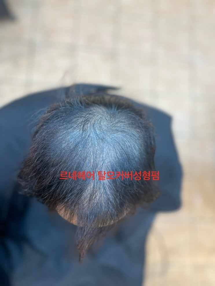  남자탈모 숱타일 자신감찾으러 머리잘하고 추천받는 헤어샵 부산사상르네시떼미용실간다