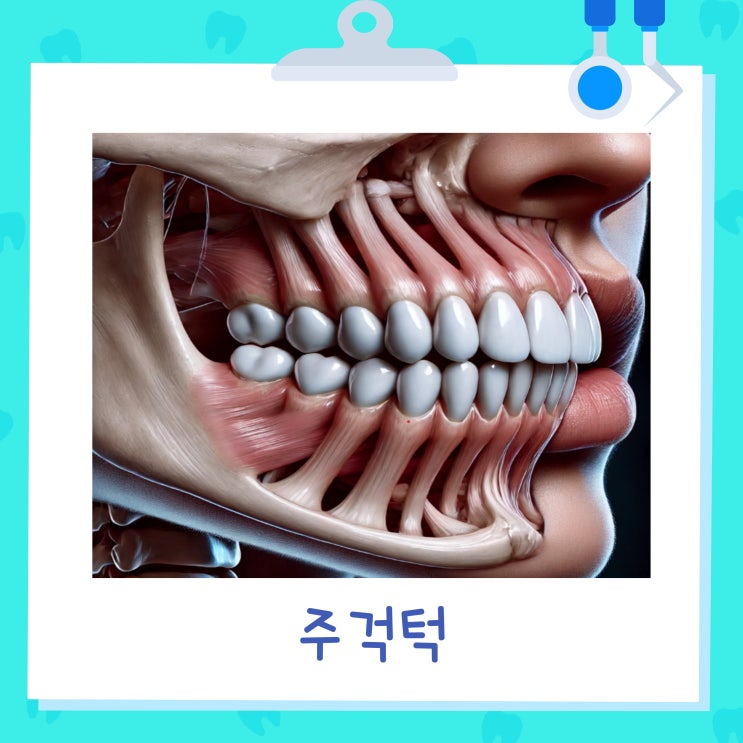  [바른약속치과 부천본원] 부정교합(잘못된 교합) 이야기