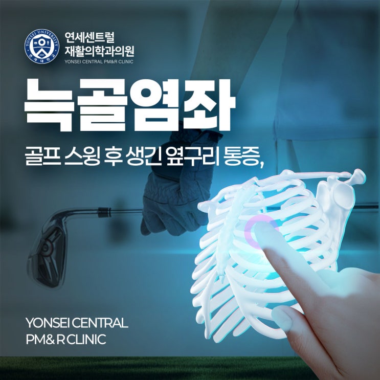  헌법재판소정형외과 골프 스윙 후 생긴 옆구리 통증, 늑골 염좌
