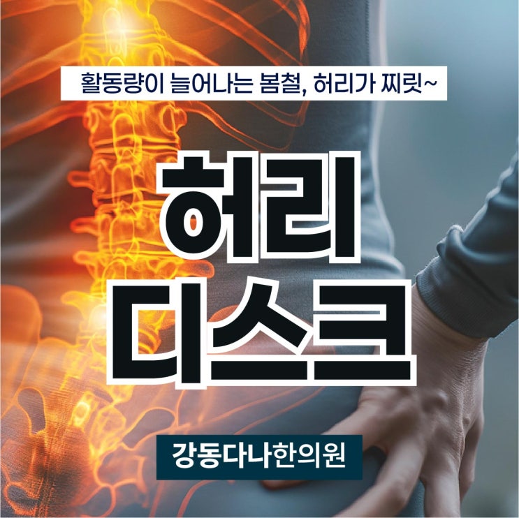  강동역허리디스크 활동량 늘어나는 봄 주의해야
