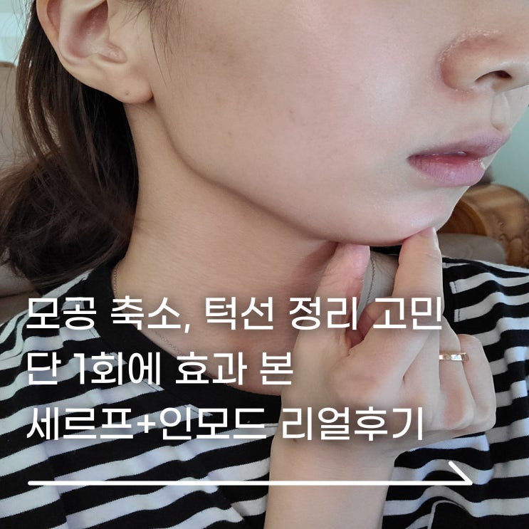  합정피부과 턱선을 살리고 모공은 조여주는, 세르프 인모드 후기
