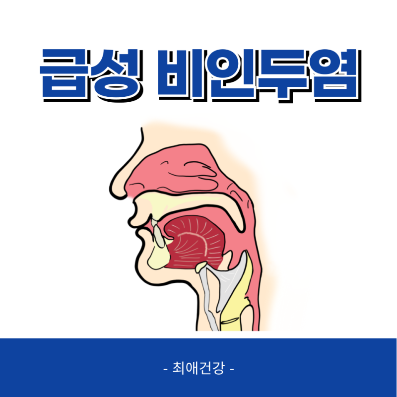 급성 비인두염 원인 증상 치료