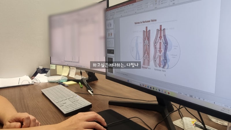 의정부 민락동 하지정맥류 내돈내산 연세고든병원에서 검사받은 후기