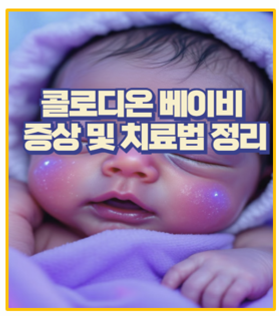  콜로디온 베이비란 인스타 화제의 희귀 질환 증상과 완치 가능성 분석