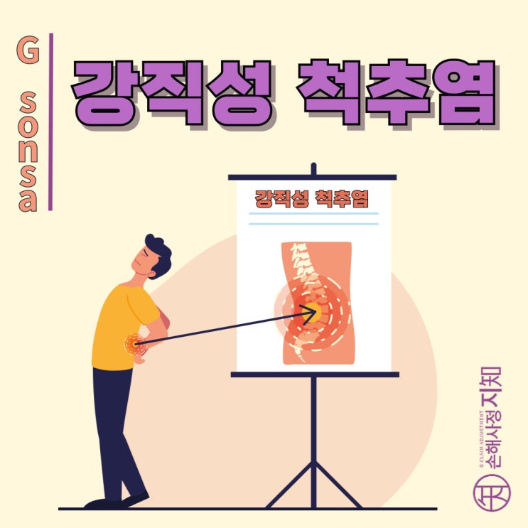  강직성 척추염, 젊은 나이에 찾아오는 특별한 요통 - 증상부터 관리까지 - [자가면역질환, AlDa]