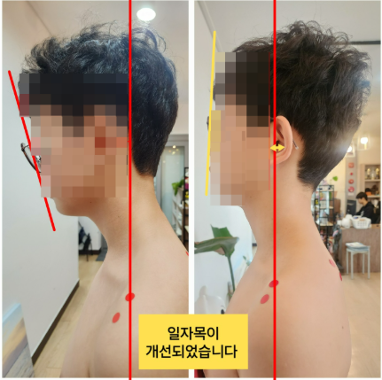  사직동 체형교정, 확실한 개선후기가 있는 이곳에서