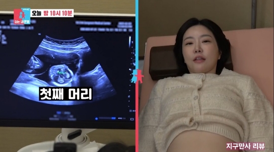 동상이몽2 <b>레이디제인 남편</b> 임현태 시험관 3차 성공 쌍둥이... 