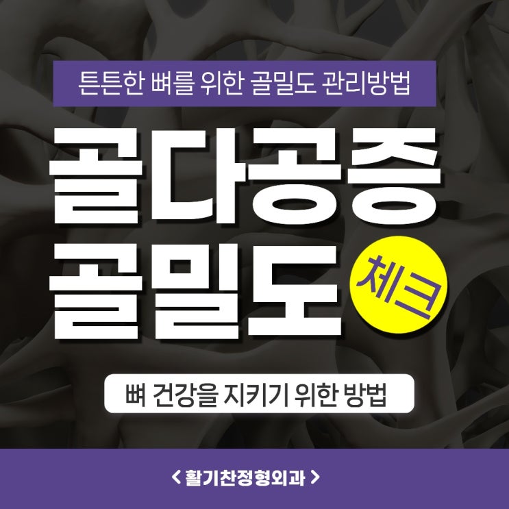  튼튼한 뼈를 위한 생활 습관, 골밀도 관리 방법