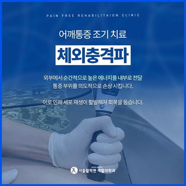 Chronic Shoulder Pain — 본문 그림