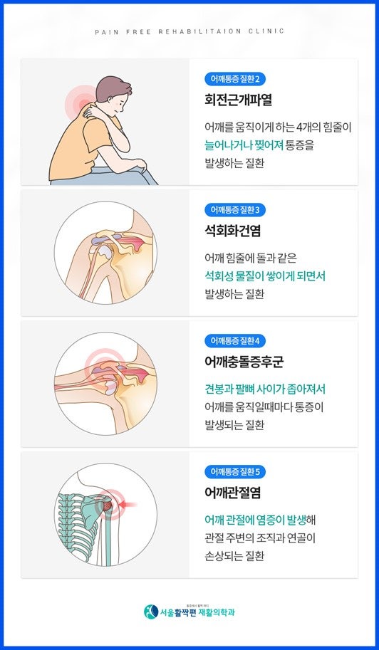 Chronic Shoulder Pain — 본문 그림