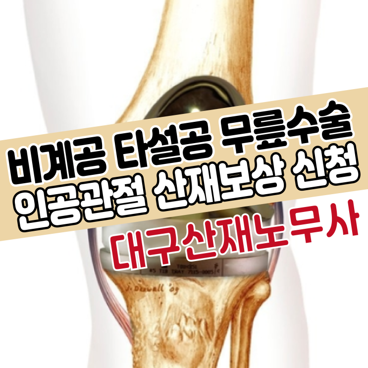  [대구 노무사] 비계공 타설공 무릎수술 인공관절 산재신청 보상사례