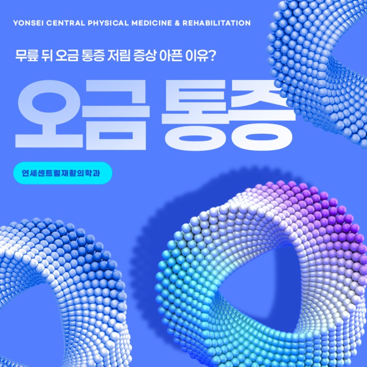  충무로정형외과 무릎 뒤 오금 통증 저림 증상 아픈 이유? 연세센트럴재활의학과
