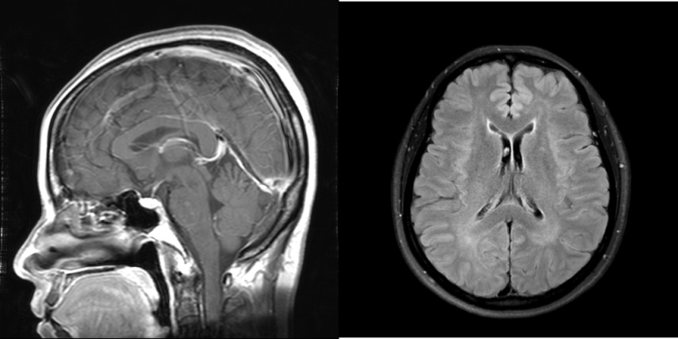  신규 간호사 MRI MRA 차이점 주의점 공부