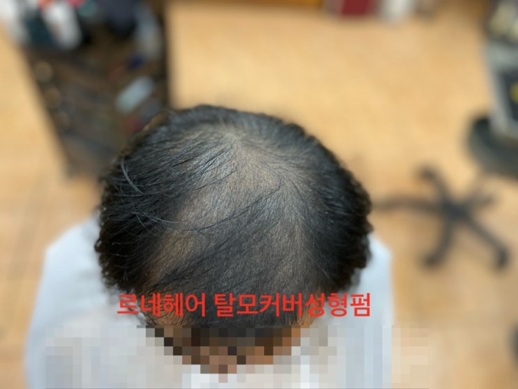  경남에서왔다구요? 두피ㅁㅅ도막지못했다 부산넘버원탈모전문미용실에서 탈모커버펌성공스토리~ 사상구추천머리잘하는 르네시떼미용실/ 대연양정연제동래사직초읍가야개금당감충무녹산명지에코정관용원진해