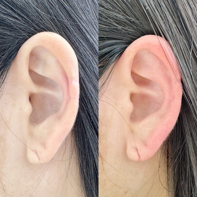  포항에스테틱 메리움뷰티 귀 건강도 챙기고 힐링까지 되는 포항 메리움뷰티 이어테라피