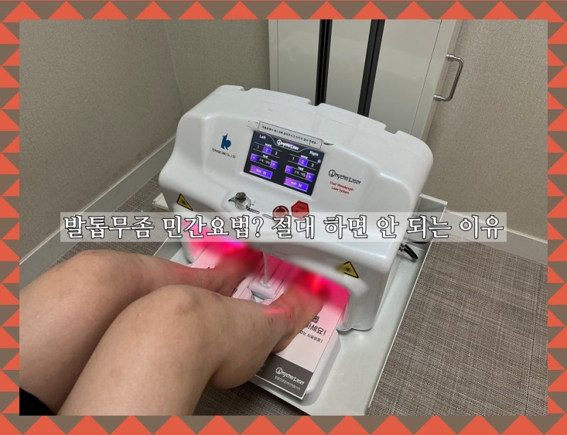 청주발톱무좀 민간요법? 절대 하면 안 되는 이유