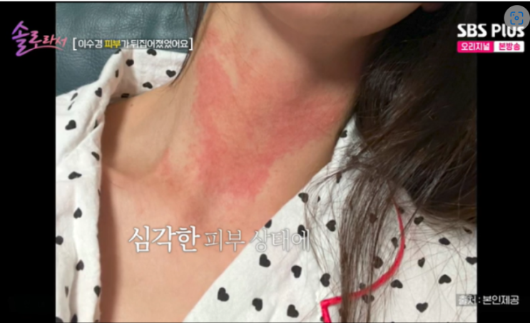 <b>이수경</b>, <b>피부병</b>으로 연예계 은퇴 고민… 그녀가 밝힌 진실