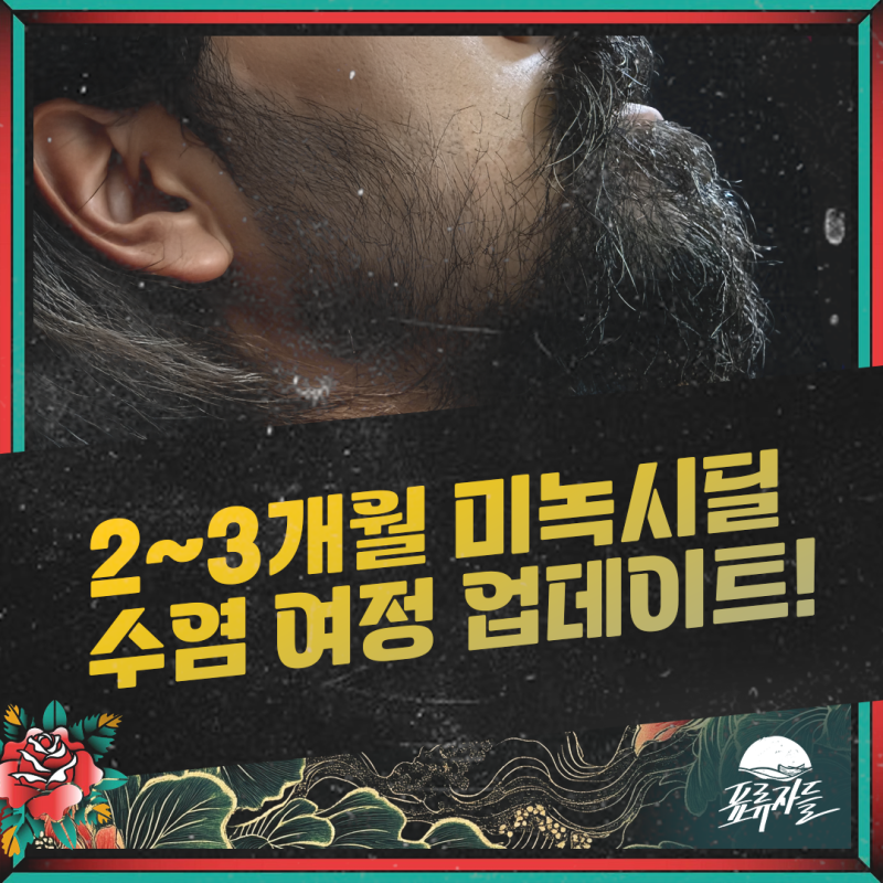 미녹시딜 수염 성장 2-3개월차 솔직 리뷰 – 현실적인 기대와 내 경험