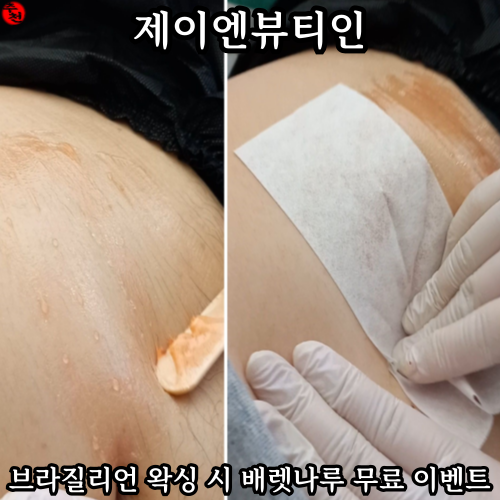 제주 브라질리언 왁싱 시 배렛나루 무료 행사 제이엔뷰티인