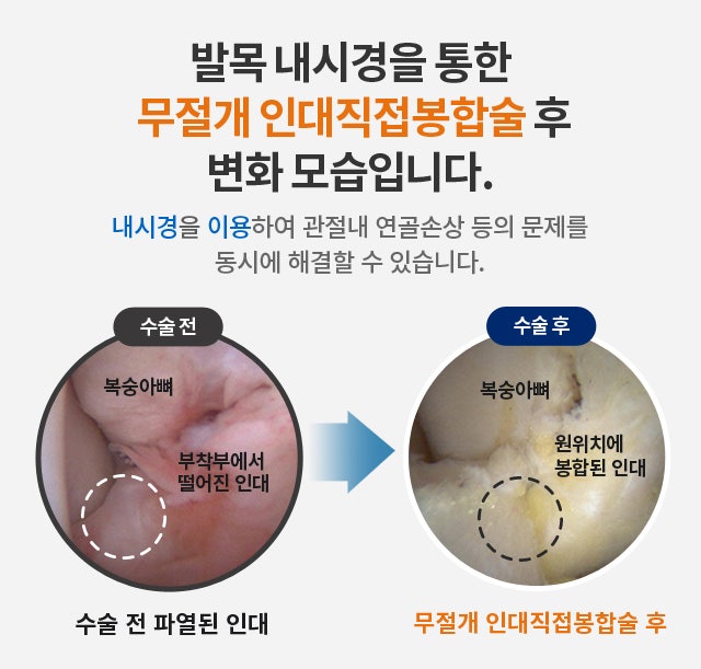 발목MRI가격 정밀한 진단과 해결이 중요합니다