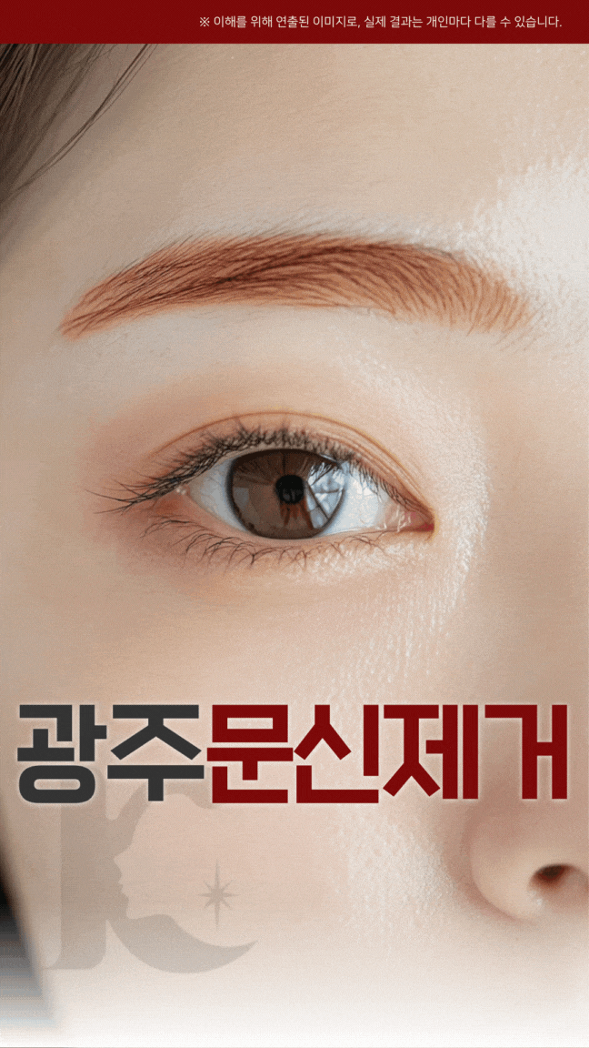  광주문신제거 수완지구 변색된 눈썹 문신제거 고민된다면