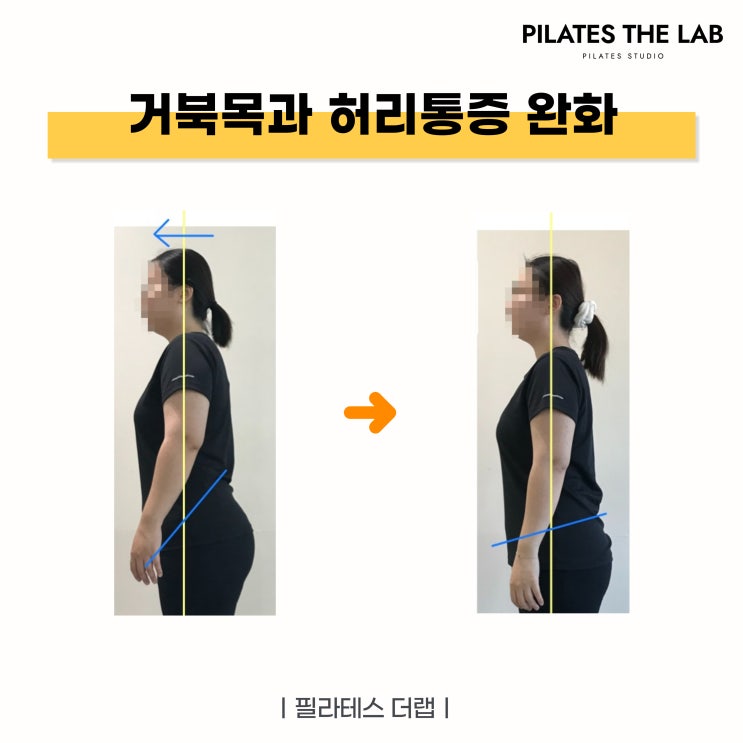  목동 필라테스로 거북목과 허리 통증 해결 - 체형 교정 사례 분석