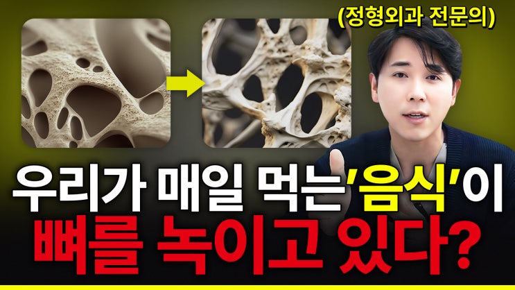  합정역 정형외과 | 정형외과 전문의가 알려주는 뼈 건강에 최악인 음식 TOP 3
