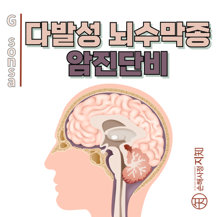  다발성 뇌수막종, 보험금 청구 거절당했다면 이 글을 읽어보세요! - [암진단비, BA+DA]