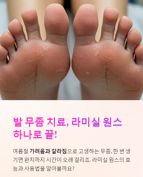  라미실 원스 효능, 사용법, 부작용, 후기 정리!
